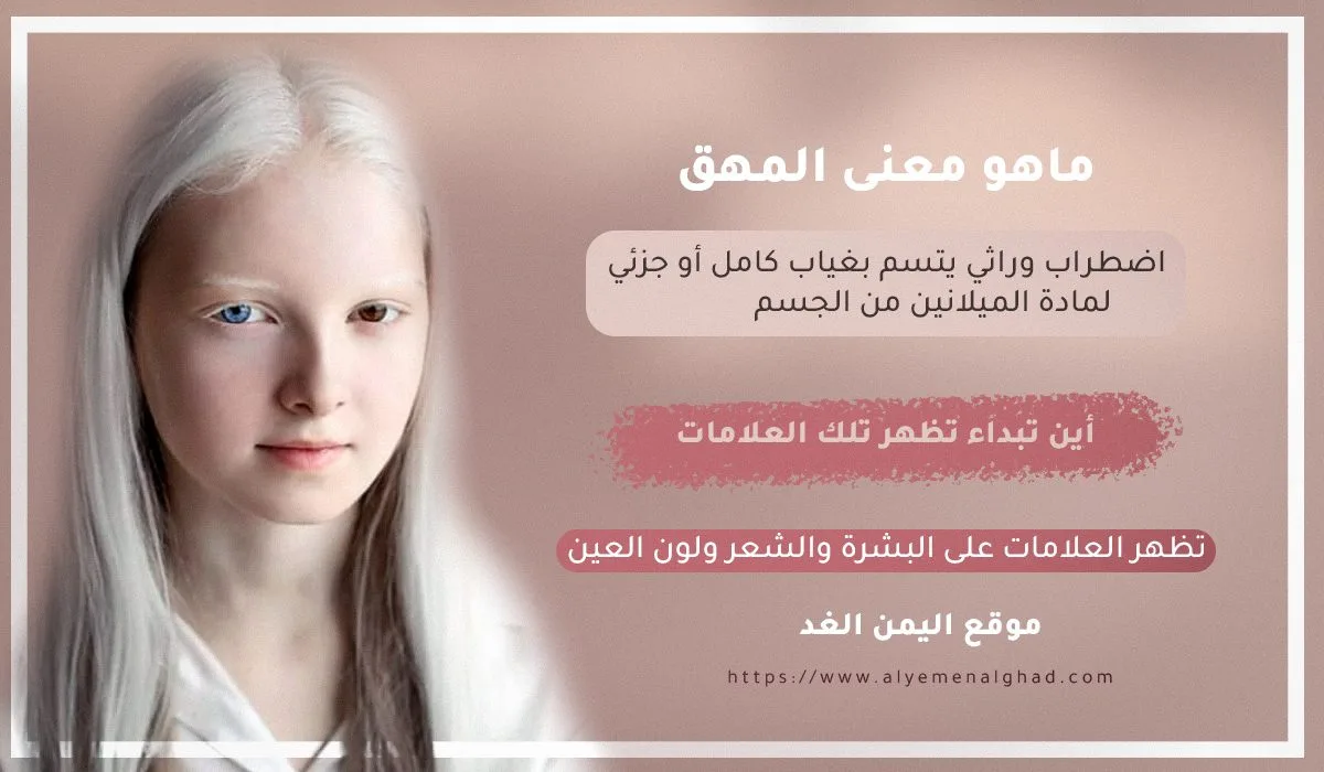 معنى المهق وماهي أعراض المهاق وأين يبداء اليوم العالمي لـ المهق