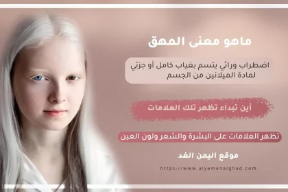 معنى المهق وماهي أعراض المهاق وأين يبداء اليوم العالمي لـ المهق