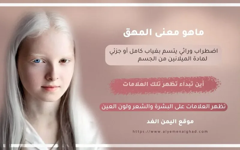 معنى المهق وماهي أعراض المهاق وأين يبداء اليوم العالمي لـ المهق