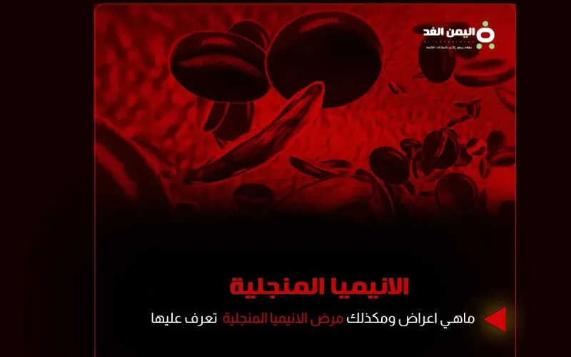 الانيميا المنجلية فقر الدم المنجلي ماهو اسباب اعراض علاج مضاعفات anemia