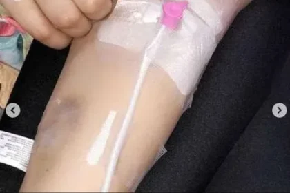 سبب مرض شذى سبت وماهو مرض شيلاء سبت