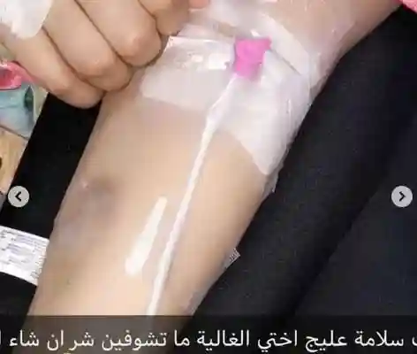 سبب مرض شذى سبت وماهو مرض شيلاء سبت