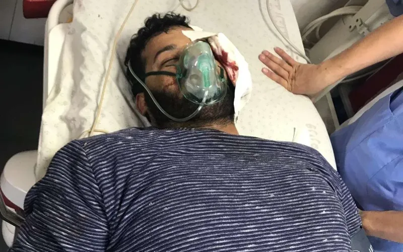 اصابة المصور الصحفي عطية درويش اليوم في غزة