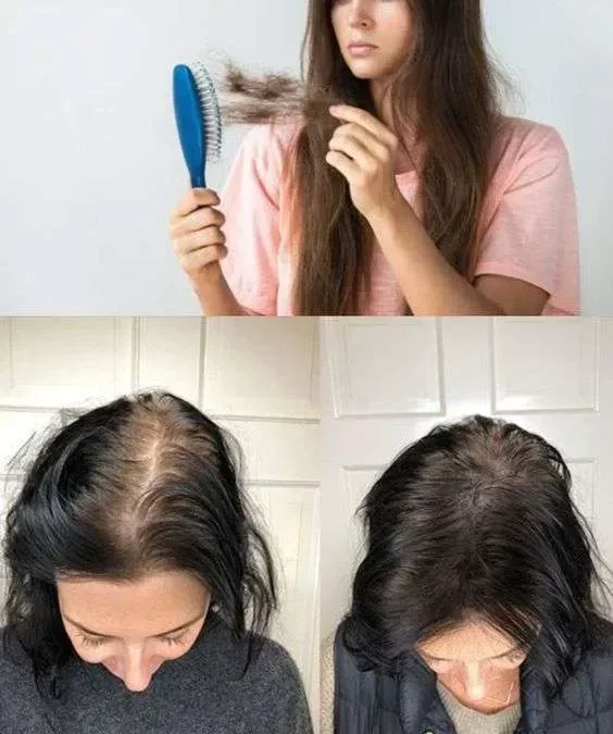 علاج تساقط الشعر 2025 افضل علاج تساقط الشعر للرجال النساء وصفات