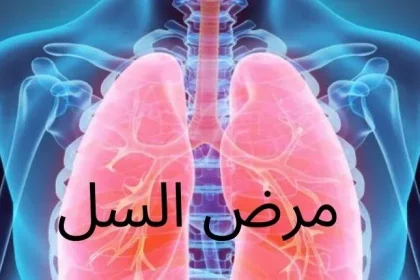 مرض السل(Tuberculosis)؛ أعراضه وأسبابه - شبكة فهرس