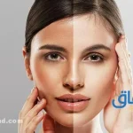 06 (كريمات تفتيح افريقية مضمونة) مكونات وفوائد 2022