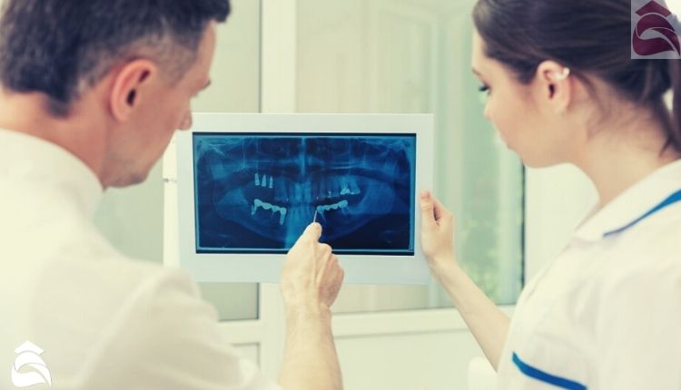الأشعة السينية للأسنان أهم 4 أنواع من تقنيات التصوير وكيفية التحضير لها 2 التحضير لأشعة الأسنان