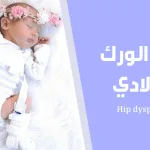 خلع الورك الولادي؛ الأسباب وطرق العلاج