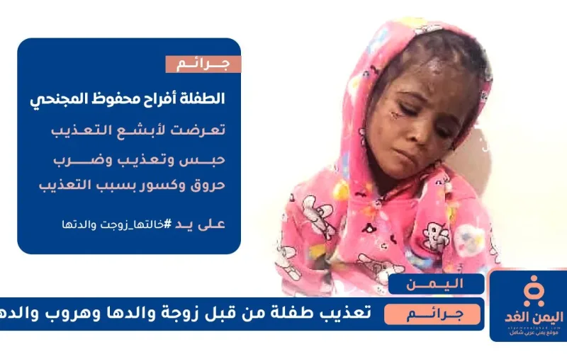 جريمة تعذيب الطفلة أفراح محفوظ المجنحي بعمر 5 سنوات
