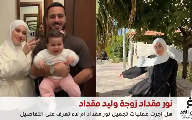 هل أجرت عملية تجميل نور مقداد زوجة وليد مقداد شاهد صور قبل وبعد