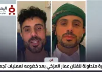 Ammar Al-Azki after cosmetic surgery