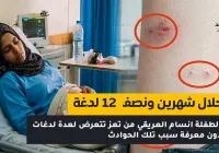 طفلة تتعرض لاكثر من 11 لدغة