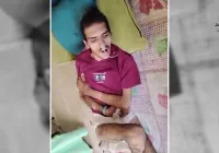 معيد في جامعة صنعاء يفقد الحركة