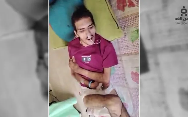 معيد في جامعة صنعاء يفقد الحركة والنظر والكلام والسبب صادم