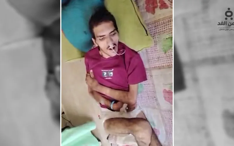 معيد في جامعة صنعاء يفقد الحركة والنظر والكلام والسبب صادم