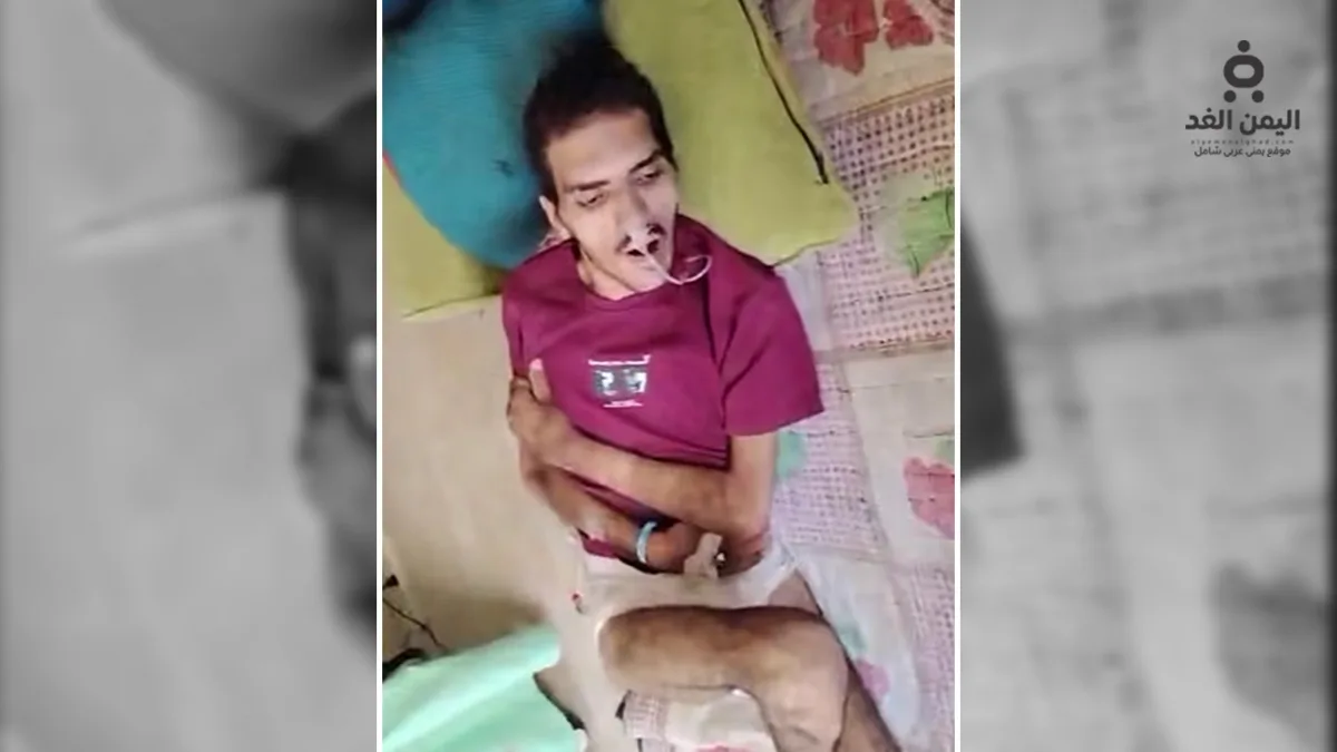 معيد في جامعة صنعاء يفقد الحركة