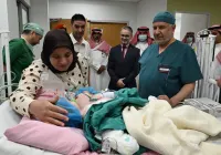 فصل التوأم المغربي سجى وضحى