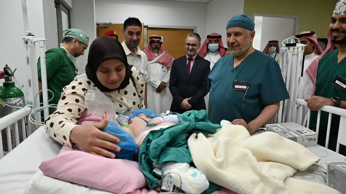 فصل التوأم المغربي سجى وضحى